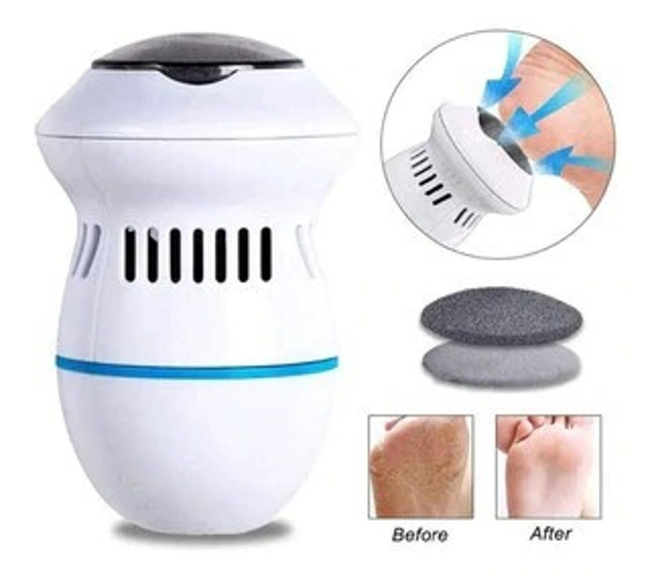 Miniatura 2 de COMBO DE REMOVEDORES CYP